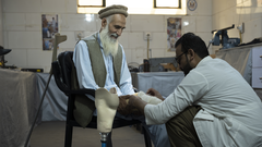 KABUL, CENTRAL AFGHANISTAN, AOAD health Clinic for Victims Assistance. Marjaan, 67 years-old. When he was 22, walked on a pressure landmine in Balkh province. Doctor Hameed Ullah, is testing a new lighter prosthesis.